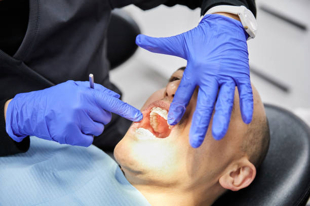 Best Broken or Cracked Tooth Emergency Dentist in Big Bear City, CA