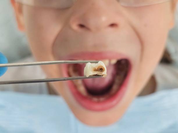 Best Mobile Emergency Dentist in Big Bear City, CA